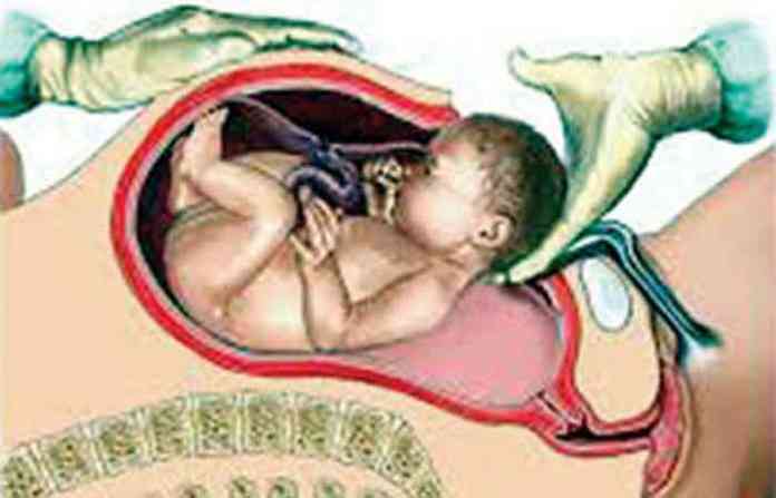 foetus