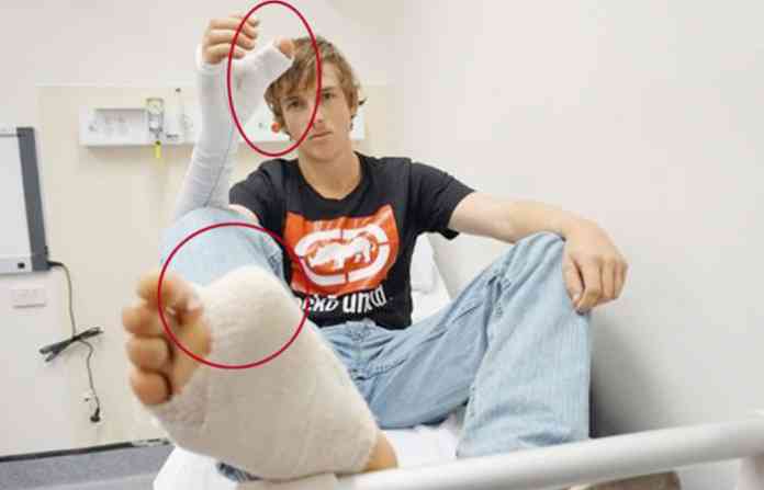 foot-thumb-hand-featured-im