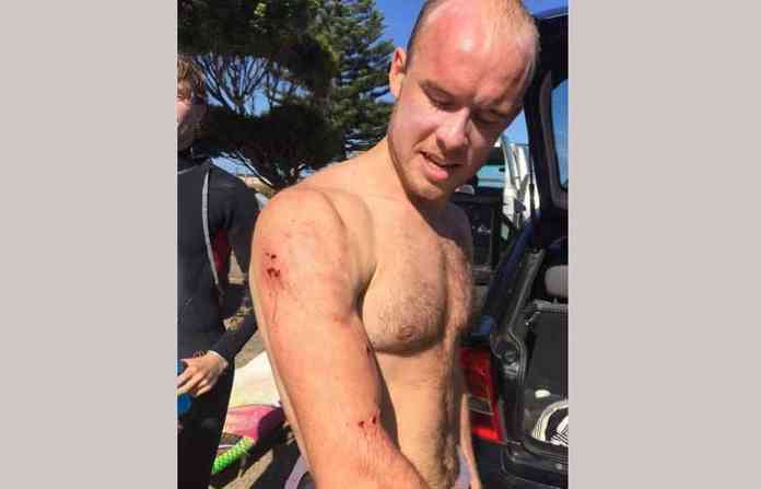 avoka-beach-injured-shark