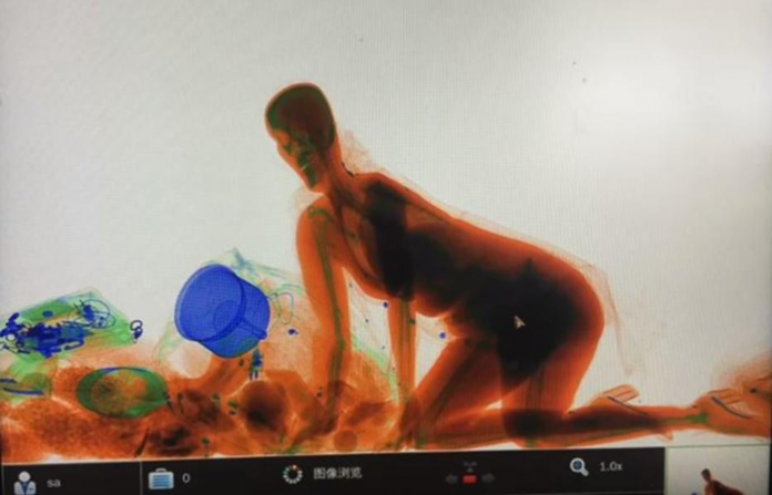 x-ray_woman-china