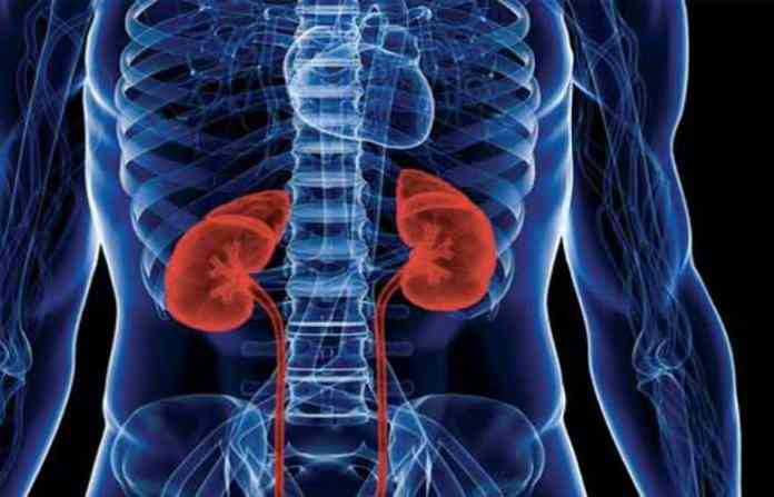 kidney-failure