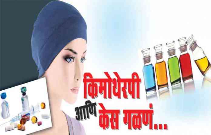 cemo-hairfall