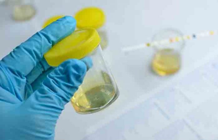 urine-test