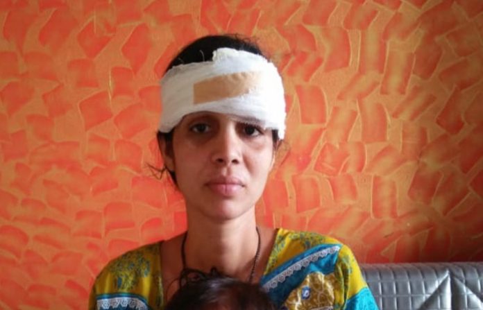 vaitarna-women-injured