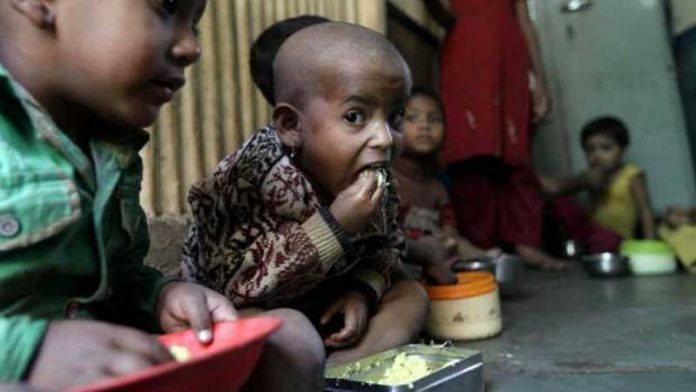 malnutrition