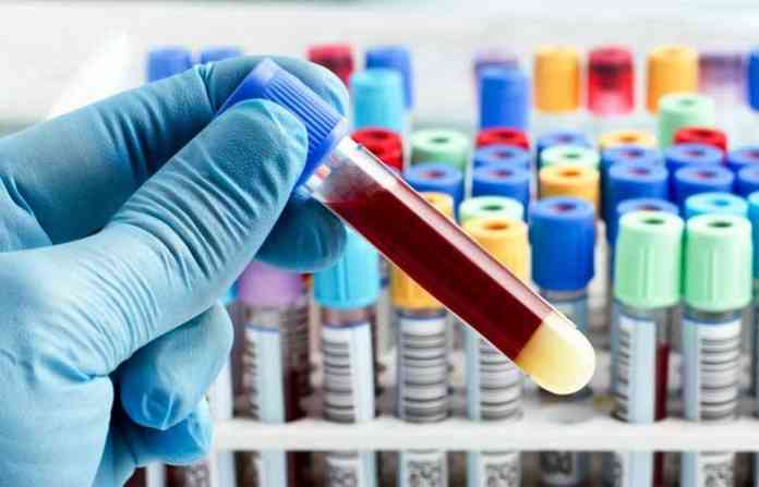 blood-test