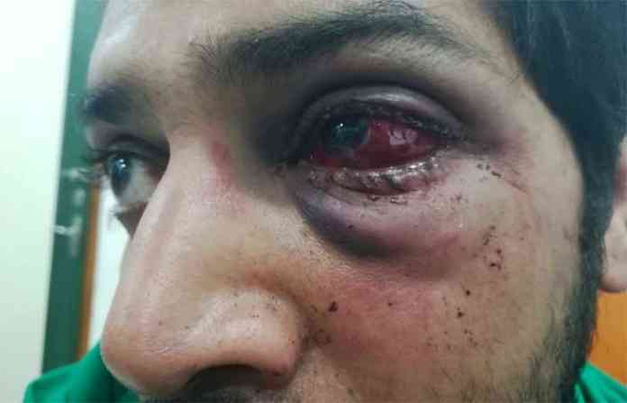 doctor-beaten-in-dhule-red