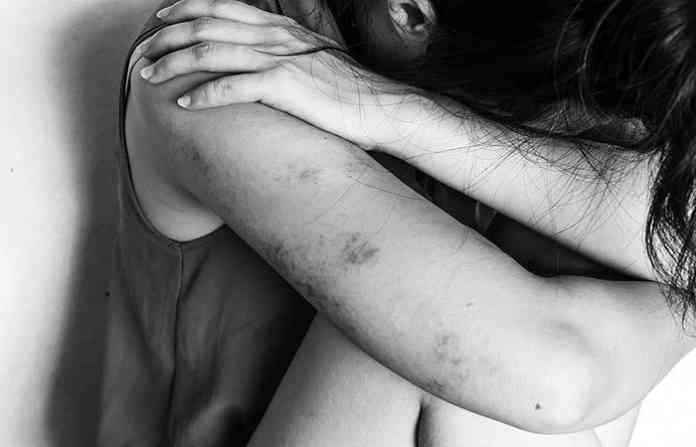 abuse_victim_credit_yupa_watchanakit_shutterstock_cna