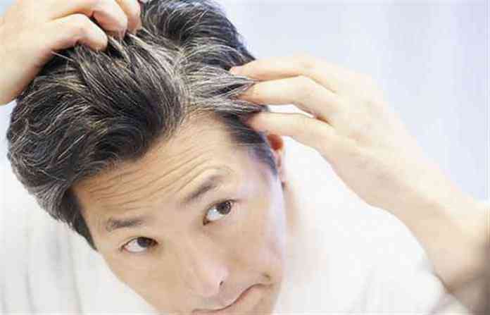 white-hair