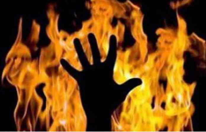 burn-alive