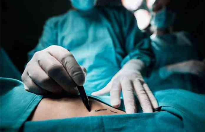 surgery9