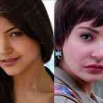 anushka-sharma-surgery