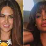 esha-gupta-surgery