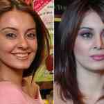 minisha-lamba-surgery