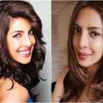 priyanka-chopra-surgery