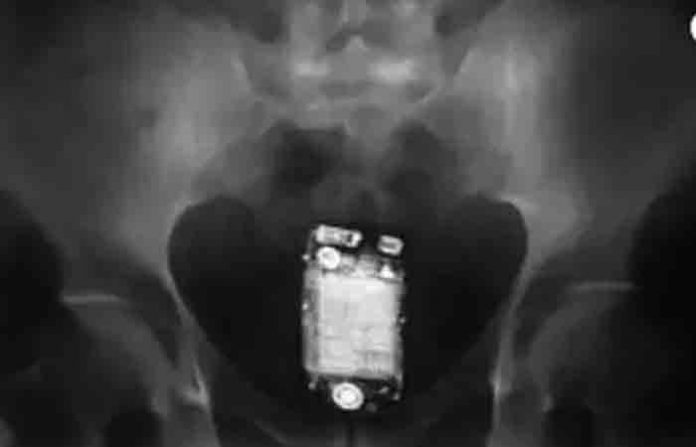 mobile-in-body