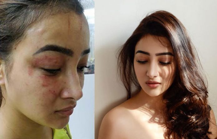 nalini-negi-beaten-by-roomm