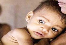 राज्यात कुपोषणामुळे पाच महिन्यांत 78 बालके दगावली