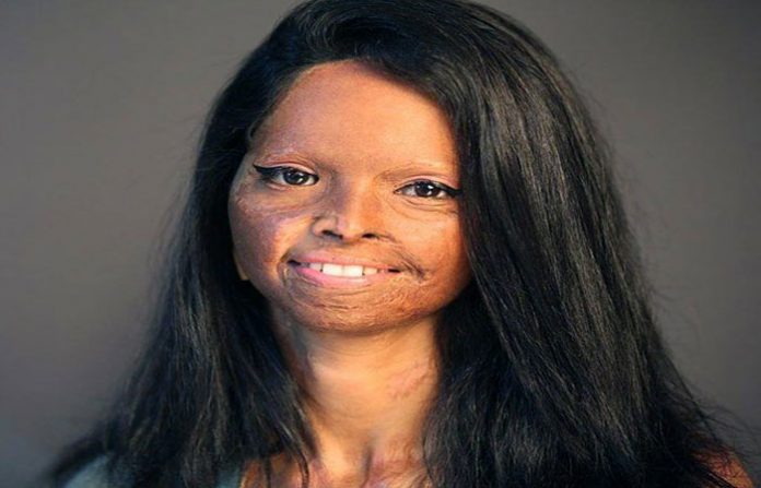 laxmi-agarwal-5