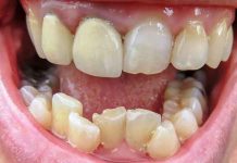 dental-treatment-new