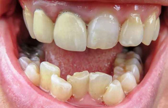dental-treatment-new dental-treatment-new