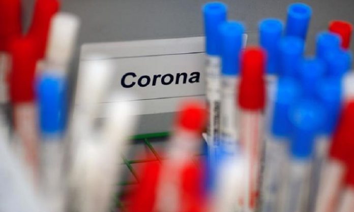 Plastic vials containing tests for the coronavirus are pictured at a medical laboratory