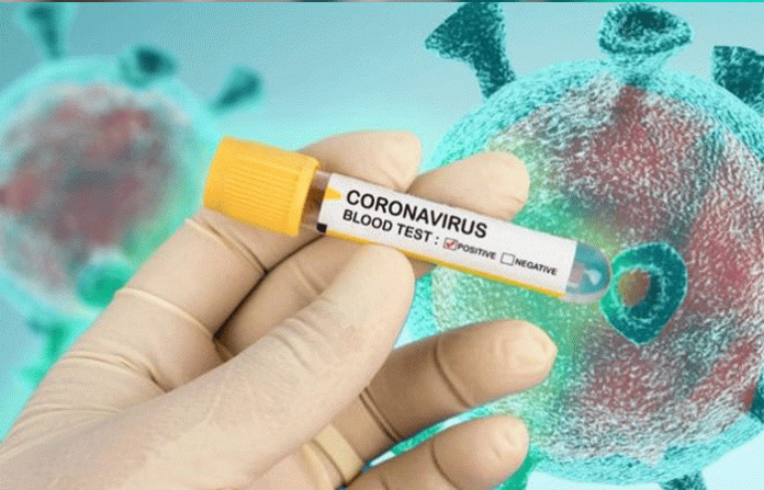 corona-negative-test