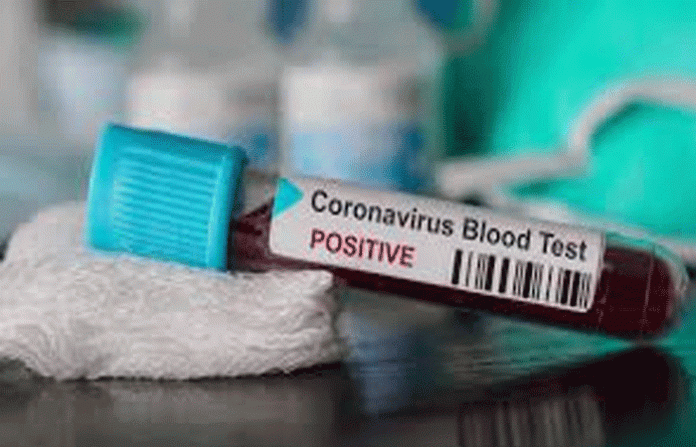 corona-test-positive