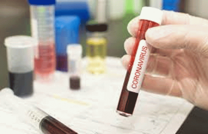 corona-virus-new-lates corona-virus-new-lates