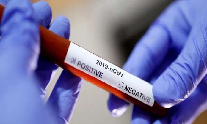 coronavirus-3