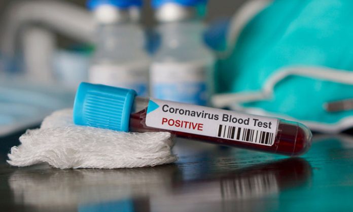 coronavirus