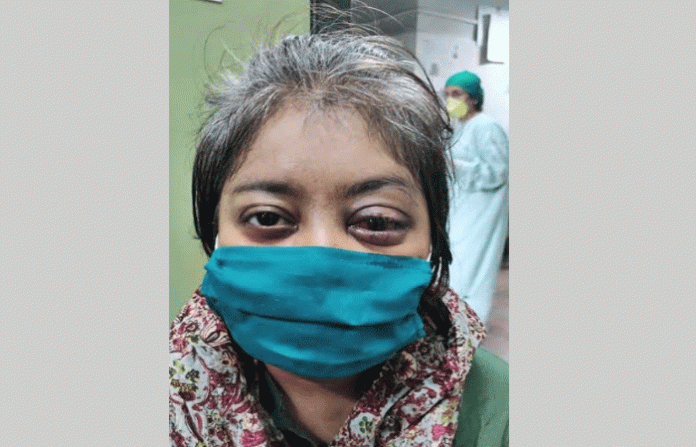 sion-hospital-eye-surgery