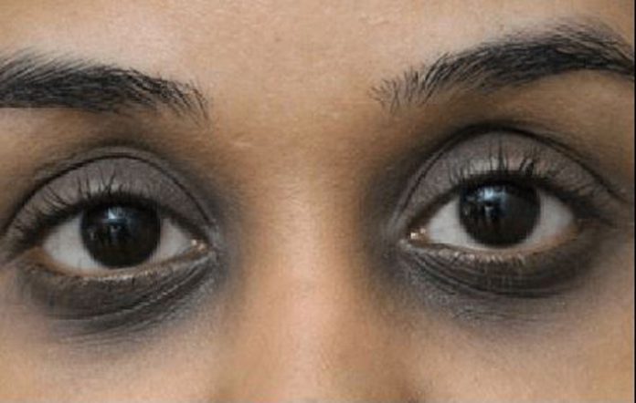 eye