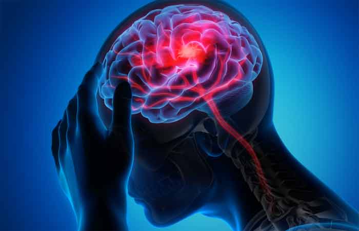 stroke-image
