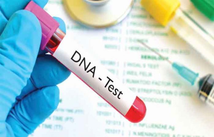 dna-test