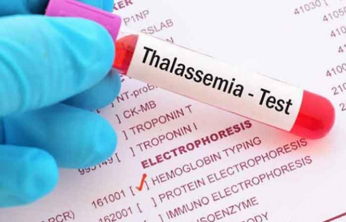 thalessemia