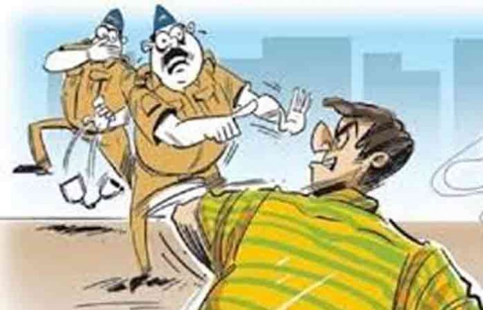 police-attack
