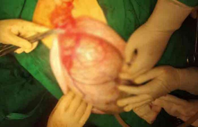 operation