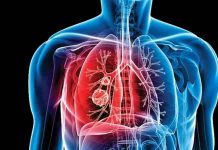 हिंदुस्थानात क्षयरोगाच्या रुग्णांत घट; जगात 25 टक्के नवे रुग्ण