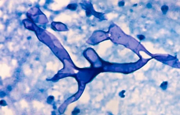 fungus