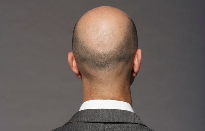 bald person generic image