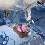 आईने दिली किडनी, किचकट शस्त्रक्रियेतून सफदरजंग रुग्णालयाच्या डॉक्टरांनी मुलाला दिले जीवदान