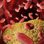 कोलेस्ट्रॉल नियंत्रित करण्यासाठी काय करायला हवे?