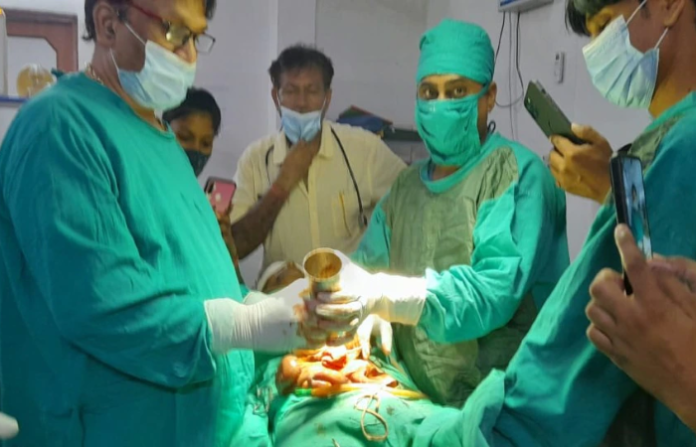 up operation