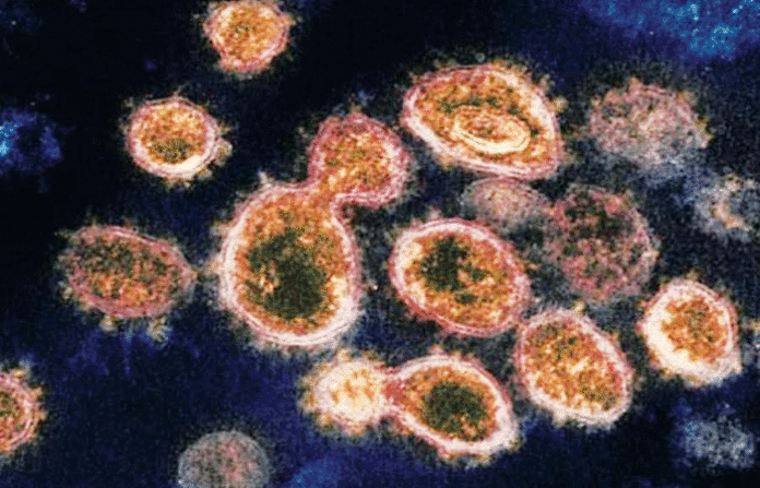 virus