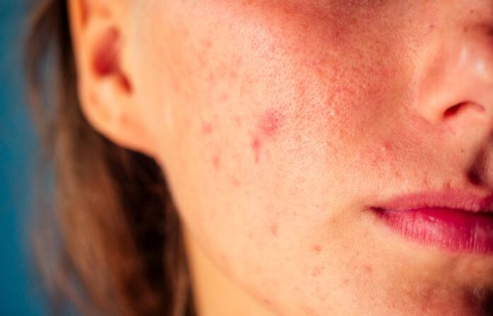 skin