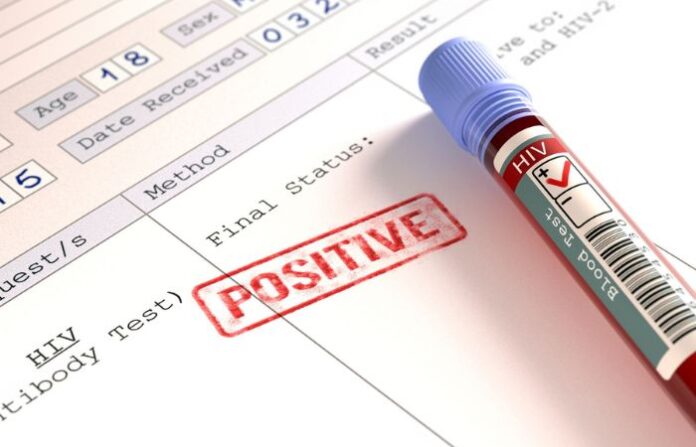 HIV positive