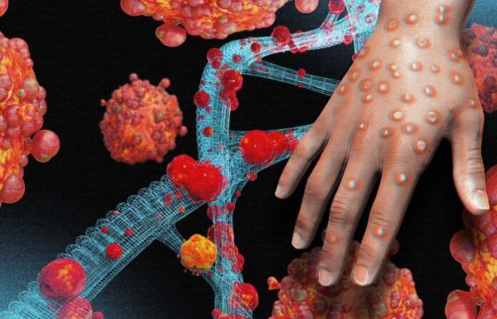 monckypox