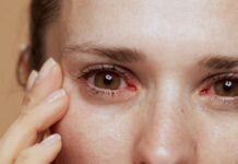 हे करून पहा- डोळ्यात कचरा गेला तर…