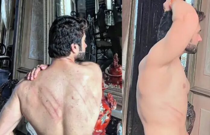 actor beaten